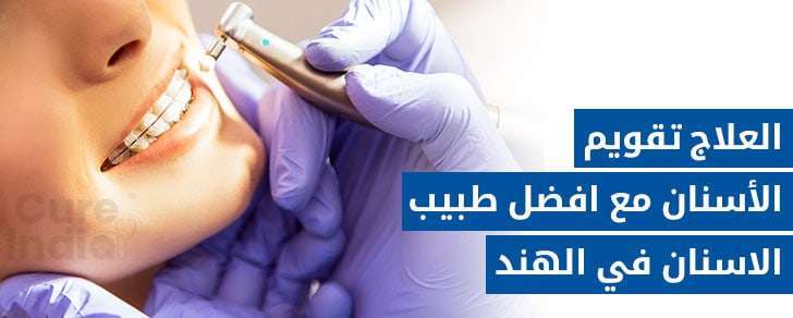تقويم الأسنان